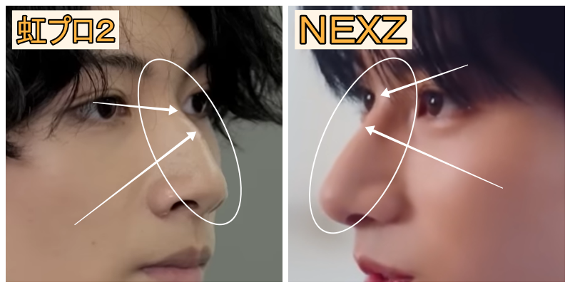 ユウの鼻整形証拠画像