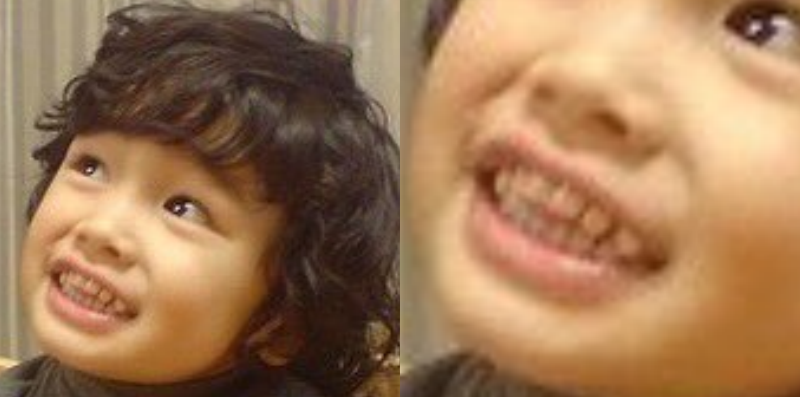 NEXZハル、子供の頃の歯並びの画像