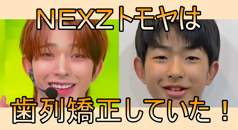 NEXZトモヤの歯列矯正検証画像