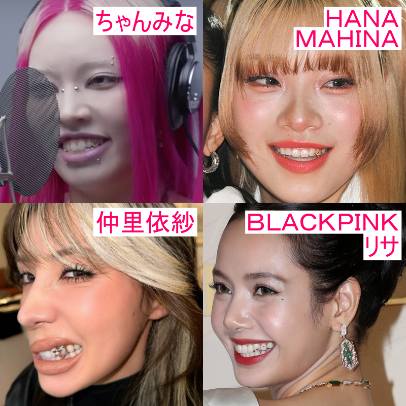 ティースジュエリーをしている芸能人の画像