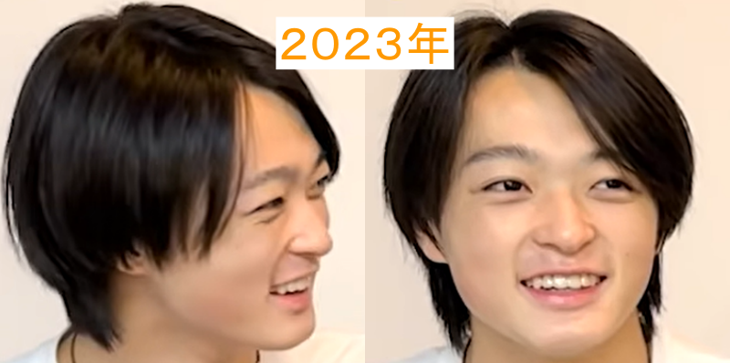 RUIの画像